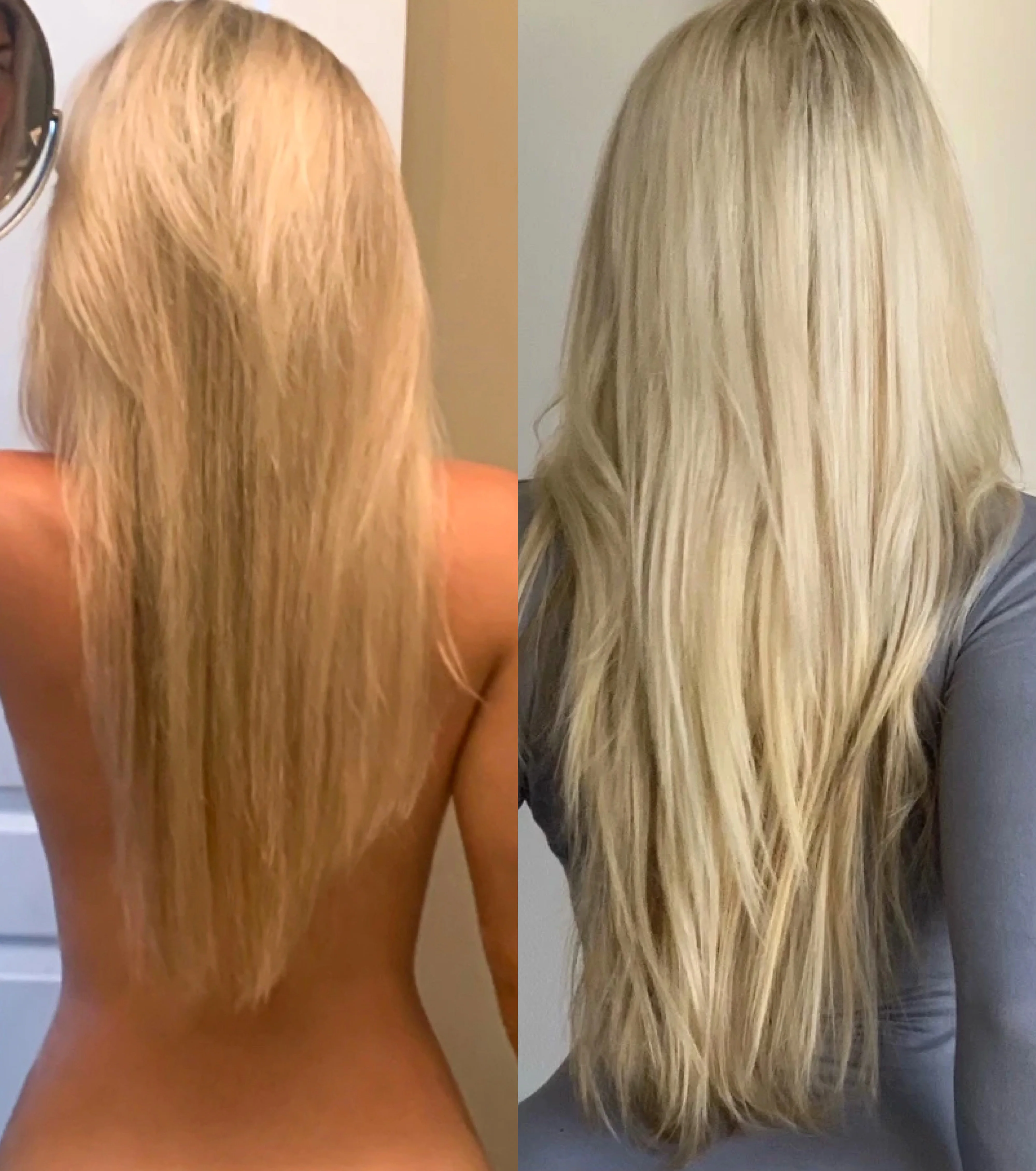 Hair Growth - Image 4